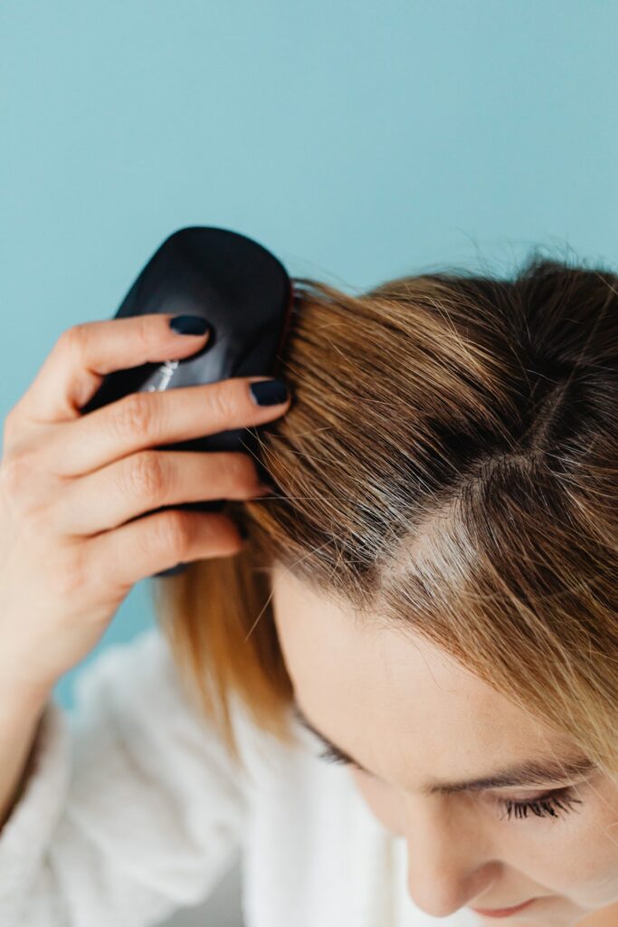 Haarausfall und lichte Kopfhaut bei junger Frau. Diese Kopfhaut und Hautprobleme treten häufig in den Wechseljahren auf.
